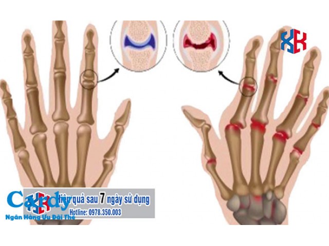 Trung Tâm điều trị xương khớp